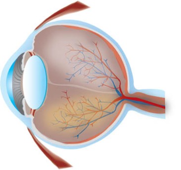 Ocular Implant Surgery by OrangeCountySurgeons.org  (2)